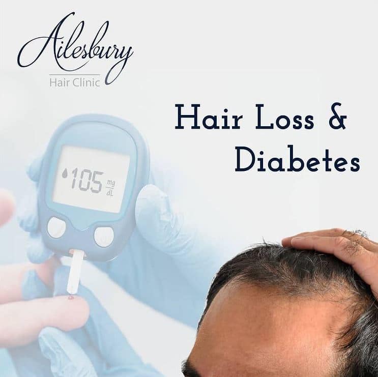 Hair loss and diabetes
